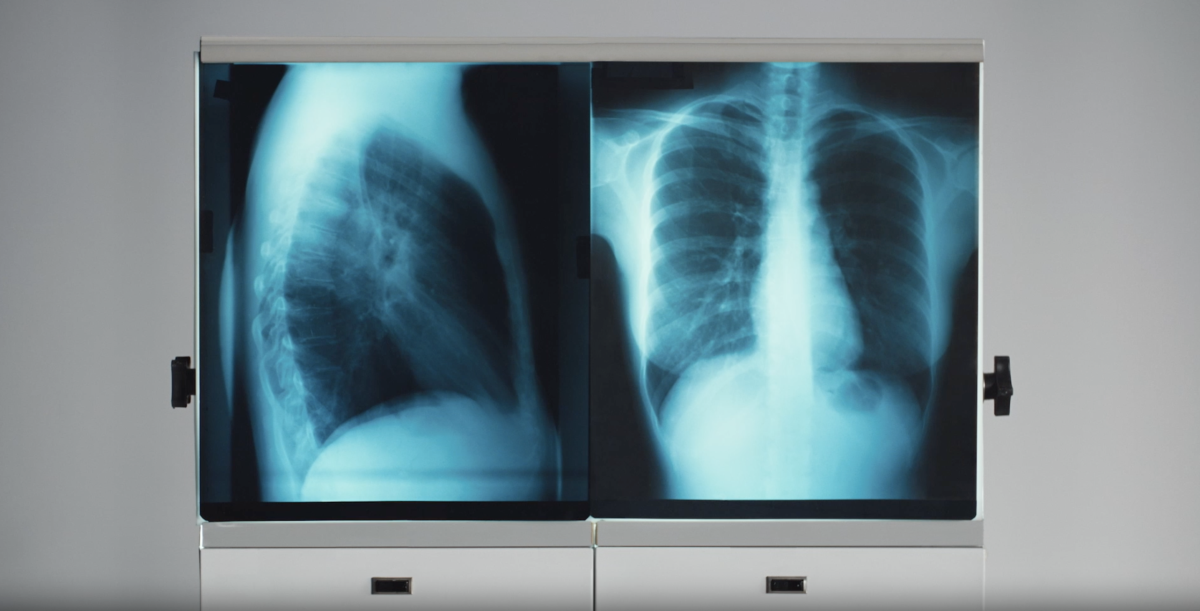 image of an x-ray